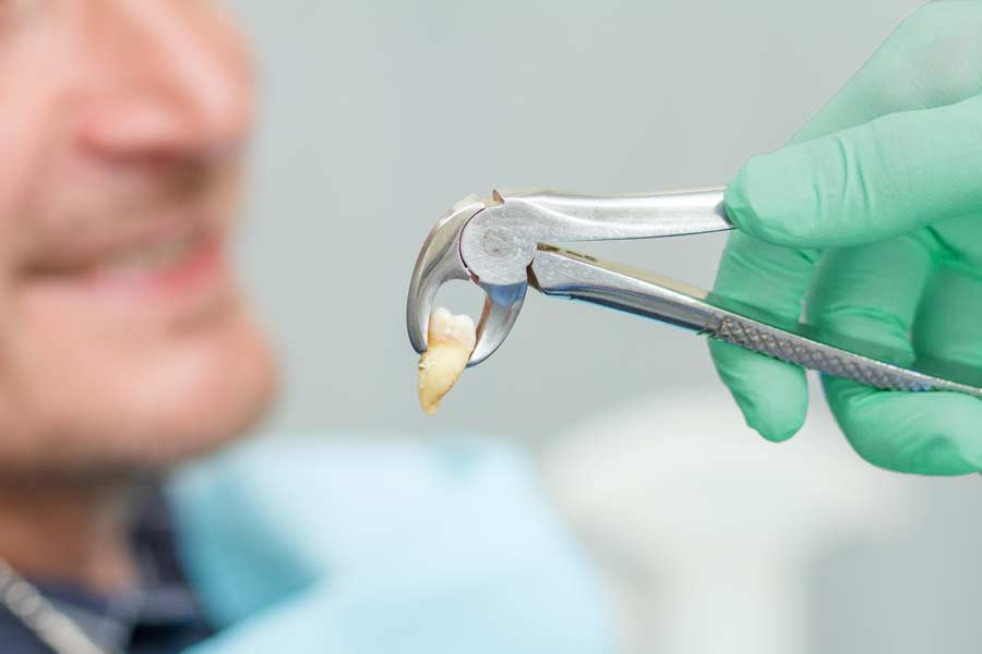 Turnersville Family Dentistry, Our Procedures, Extractions